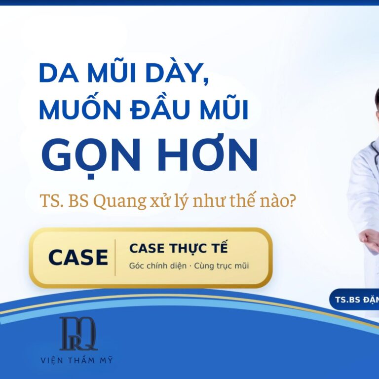 Với nền da mũi dày, TS.BS Đặng Xuân Quang làm gọn đầu mũi như thế nào?