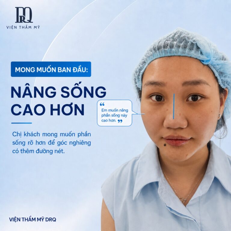 Khách muốn nâng sống cao hơn nhưng điều TS.BS Đặng Xuân Quang chú ý đầu tiên lại là đầu mũi