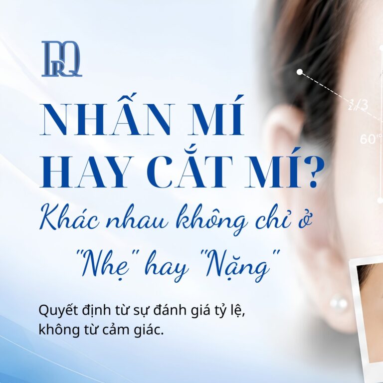 Nhấn mí hay cắt mí: Khác nhau không chỉ ở “nhẹ” hay “nặng”
